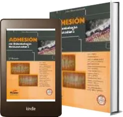 Descargar Adhesion en Odontologia Restauradora PDF 2023 + ePub