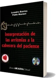 Interpretacion de Las Arritmias a la cabecera Del Paciente eBook completo gratis