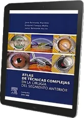 [PDF] LIBRO Atlas de Tecnicas Complejas en la Cirugia Del Segmento anterior 2023 Google Drive