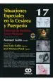 PDF Situaciones Especiales en la Cesarea y Puerperio del autor Manuel Gallo