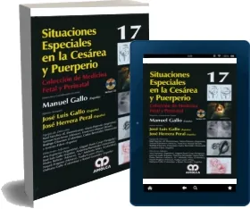 Situaciones Especiales en la Cesarea y Puerperio Libro completo PDF y eBook
