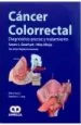 PDF Cancer Colorrectal. Diagnostico Precoz y Tratamiento del autor Susan l. Gearhart