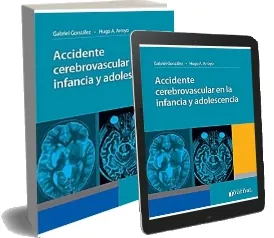Descargar Accidente Cerebrovascular en la Infancia y la Adolescencia PDF | Hugo Arroyo 2023
