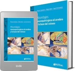 «Abordajes Neuroquirúrgicos al Cerebro y la Base de Cráneo» completo en formatos HTM, DOC, WORD, LIT, OPF, PDF, KFX, LRF, TXT, DOCX, EPUB - Journal descargar libro gratis 2023