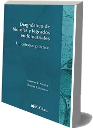 Diagnostico de Biopsias y Legrados Endometriales. Un Enfoque Practico [PDF] libro Mega