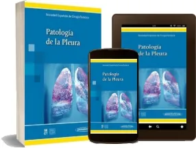 Leer «Patologia de la Pleura» descarga online + eBook