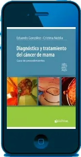 Leer y descargar Diagnostico y Tratamiento Del Cancer de Mama. Guia de Procedimientos de Eduardo Gonzalez Mega