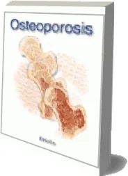 Descargar «Osteoporosis - Miniatlas» libro gratis 160 páginas | Luis Raúl Lepori 2023 Google Drive