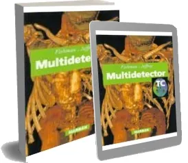 Leer Tc Multidetector libro gratis en PDF Google Drive