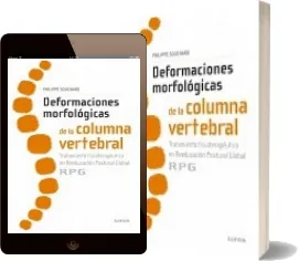 Deformaciones Morfologicas de la Columna Vertebral. Tratamiento Fisioterapeutico en Reeducacion Postural... Mejor torrent descargar libro