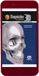 Descarga libro Diagnostico 3d en Ortodoncia. Tomografia Cone- Beam Aplicada para móvil Mega