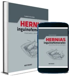Descargar «Hernias Inguinofemorales» eBook free Alberto Acevedo PDF 2022 Mega