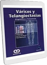 Descargar PDF - ePub Varices y Telangiectasias. Diagnostico y Tratamiento 2023 Mega
