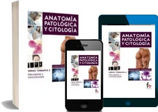 Leer online Anatomia Patologica y Citologia: Necropsias y Macroscopia gratis PDF Mega