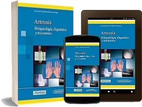 Libro Artrosis. Fisiopatologia, Diagnostico y Tratamiento online PDF Google Drive