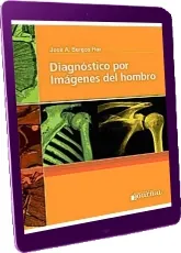Diagnostico por Imagenes Del Hombro descarga gratis online + eBook