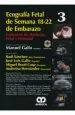 PDF Ecografia Fetal de Semana 18-22 de Embarazo del autor Manuel Gallo