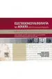 PDF Electroencefalografia Del Adulto Adult Electroencephalography. Atlas Bilingüe Español- Ingles Basado e... del autor Jorge Iriarte