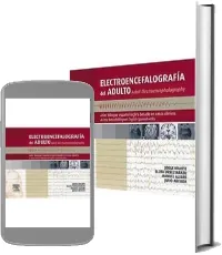 Descarga «Electroencefalografia Del Adulto Adult Electroencephalography. Atlas Bilingüe Español- Ingles Basado e...» de Jorge Iriarte en español completo 2023 + eBook