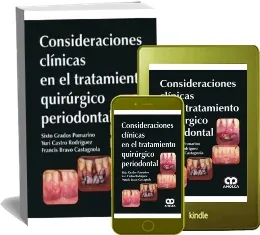 Leer PDF Consideraciones Clinicas en el Tratamiento Quirurgico Periodontal gratis por MEGA