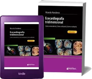 Bajar gratis Ecocardiografia Tridimensional: Cómo Entenderla, Cómo Utilizarla, Cómo Realizarla 1 link PDF «Ricardo Ronderos» Mega
