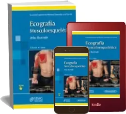 ePub Ecogragia Muculo Esqueletica. Atlas Ilustrado leer online Google Drive