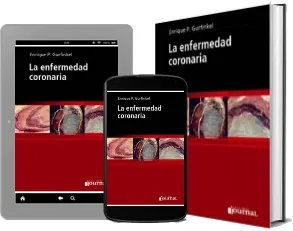 Google Books: La Enfermedad Coronaria de Enrique p. Gurfinkel en PDF edición 2023 | Android - iPhone descargas ilimitadas