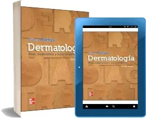 Descargar Dermatologia. Atlas, Diagnostico y Tratamiento online PDF Google Drive