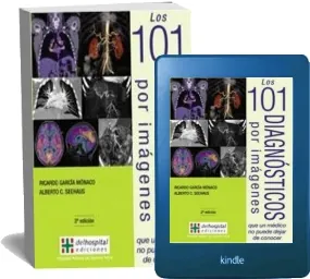 Bajar Los 101 Diagnosticos por Imagenes Que un Medico no Puede Dejar de Conocer, 2da. Ed. Libro completo (Del Hospital ed Hosp Italiano) 